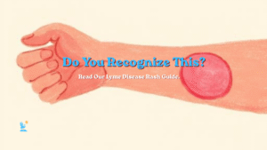 lyme disease rash