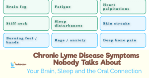 Chronic Lyme Disease Symptoms Nobody Talks About (3) (1)