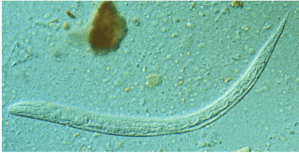 Strongyloides stercoralis larva seen under a microscope